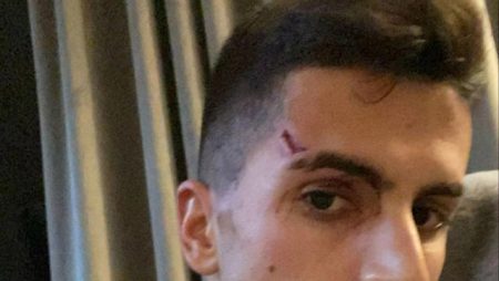 Joao Cancelo of Manchester City claims he was injured in a robbery.